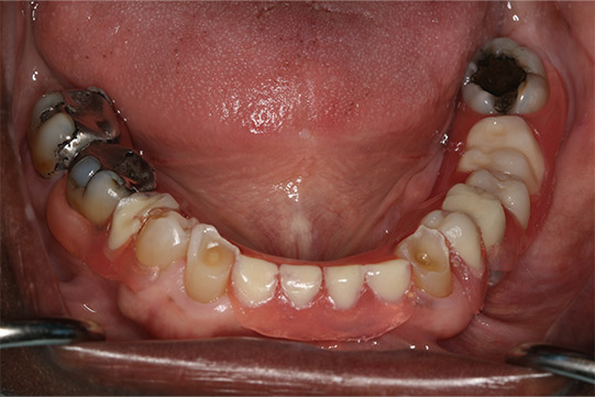 before and after 19